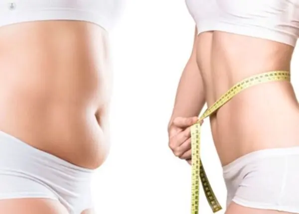 Liposuction in Cancun