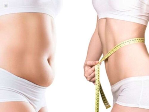 Liposuction in Cancun